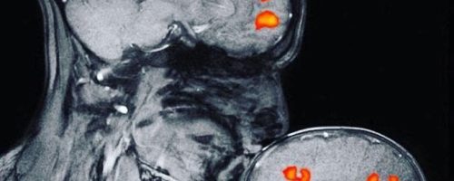 Η ΕΝΕΡΓΕΙΑ ΤΗΣ ΑΓΑΠΗΣ